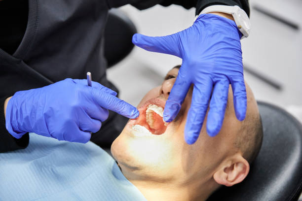 Best Urgent Tooth Repair  in Palo Cedro, CA
