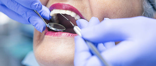 Best Knocked-Out Tooth Emergency  in Palo Cedro, CA
